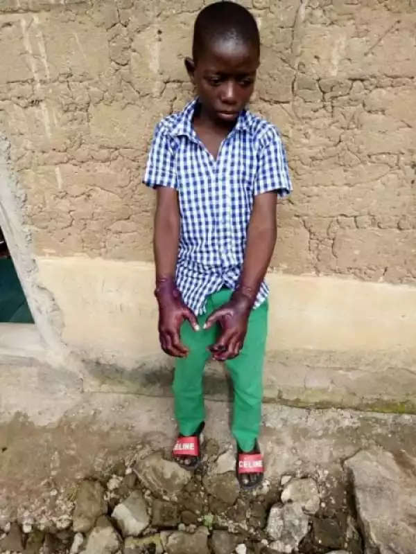 Woman Burns The Hands Of Her Stepson In Nasarawa (Viewers